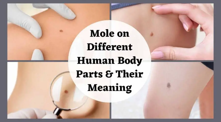 Mole on Different Human Body Parts and Their Meaning