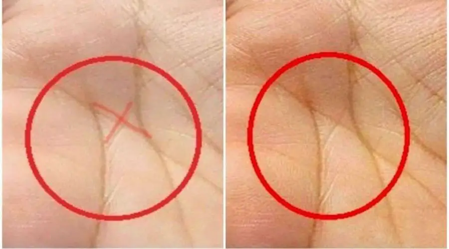 Do you have an X Sign on Your Palm? Know What Palmistry says about it