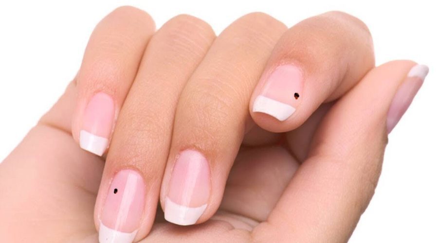 What does Astrology say about Black Mark On Nails?