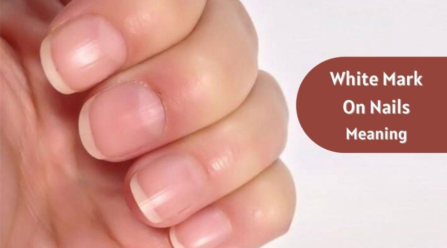 What does White Mark On Nails tell About You?