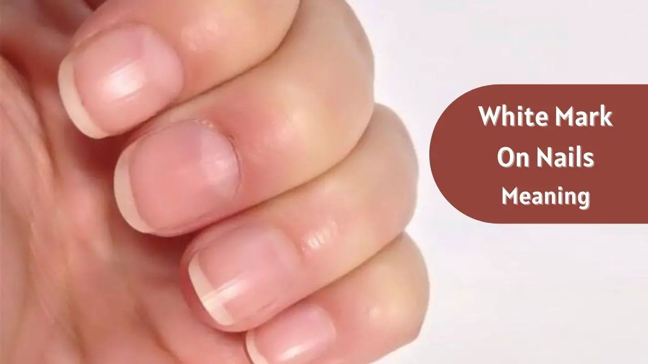 What does White Mark On Nails tell About You? - eAstroHelp