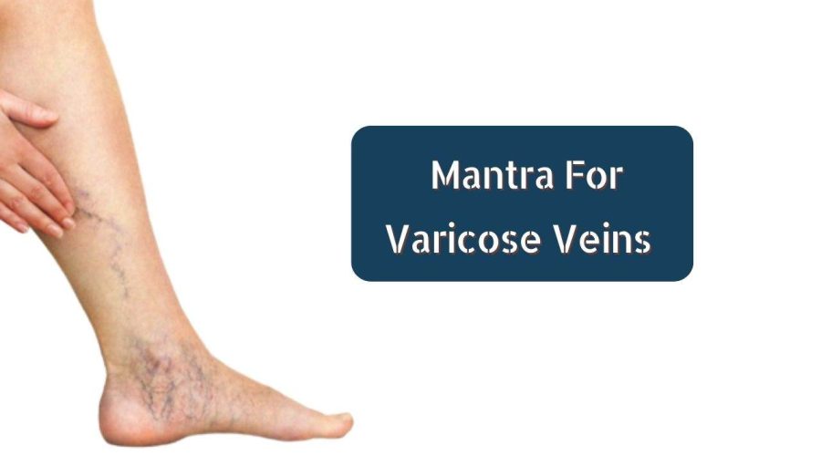 Suffering from Varicose Veins | Chant this Mantra for Cure