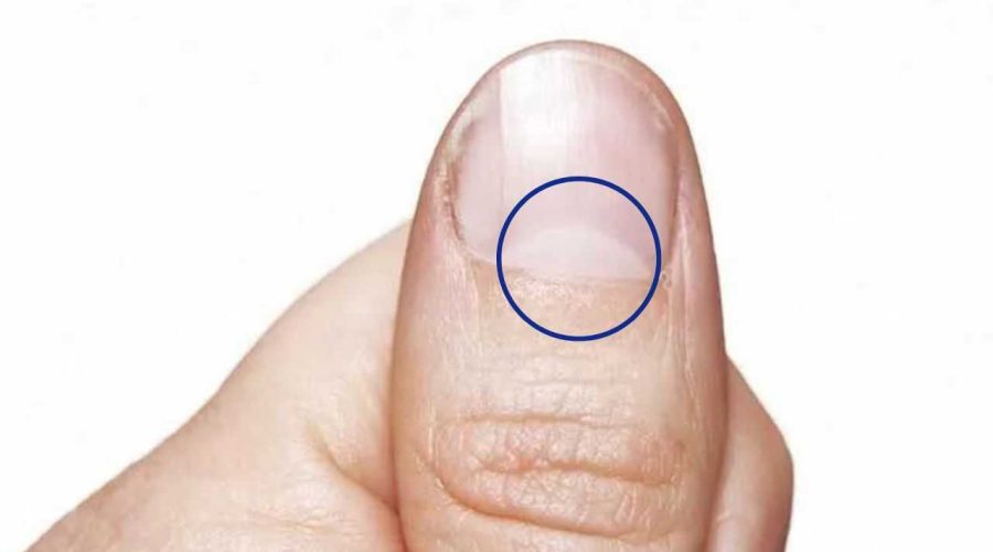 Your Fingernails Can Reveal a lot About Your Health | Half Moon on Nails means Astrology