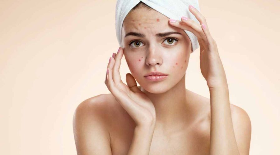 Know the 6 Types Of Pimples and Their Treatments | Seed in the Pimple