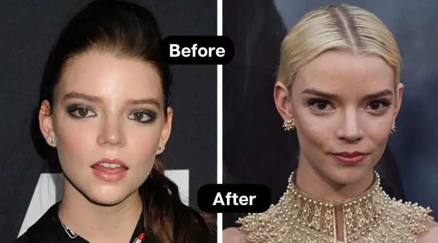 Secret to Anya Taylor Joy’s Weight Loss Story