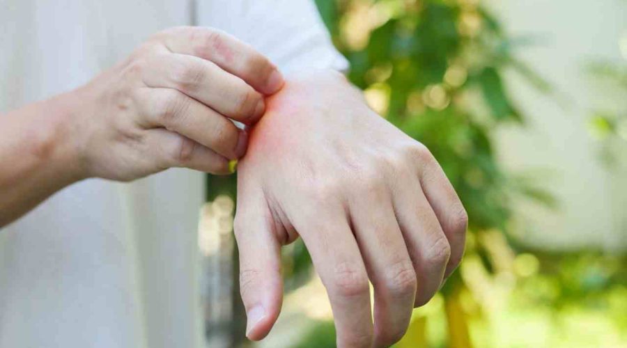 Right-Hand Itching Meaning –  What Does it Mean for Your Right Hand to Itch