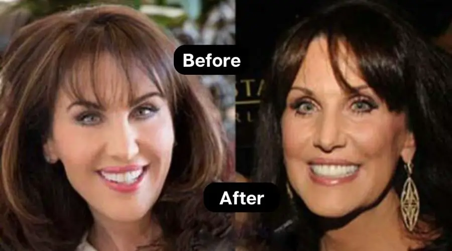 Secret to Robin Mcgraw’s Weight Loss Story