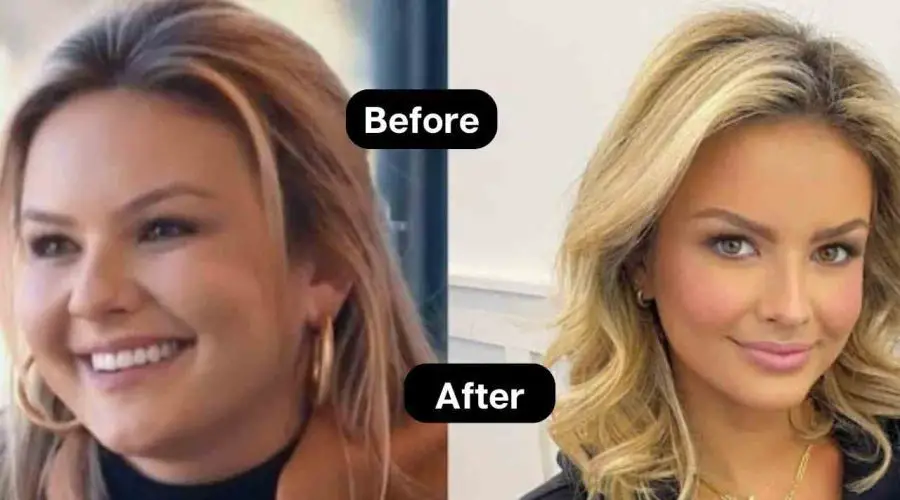 Know The Secrets of Emmy Medders Weight Loss Journey