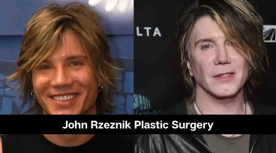 Know The Secrets of John Rzeznik Plastic Surgery – Detail