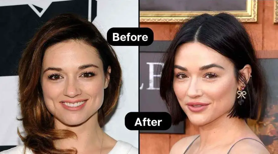 Know Everything About Crystal Reed Plastic Surgery & Relationship